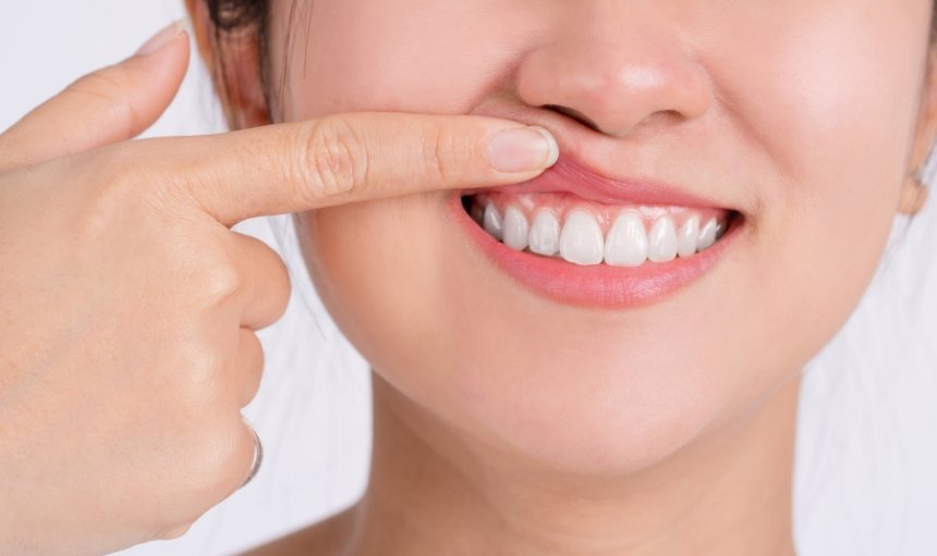 Periodoncia